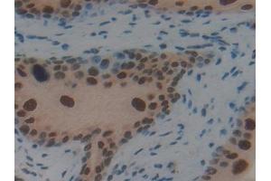 Detection of IRF2 in Mouse Ovary Tissue using Polyclonal Antibody to Interferon Regulatory Factor 2 (IRF2)