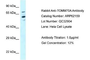 Western Blotting (WB) image for anti-Translocase of Outer Mitochondrial Membrane 70 (TOMM70A) (N-Term) antibody (ABIN786547) (TOM70 anticorps  (N-Term))