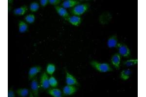 Detection of CYCS in Human MCF7 Cells using Monoclonal Antibody to Cytochrome C (CYCS) (Cytochrome C anticorps  (AA 5-100))