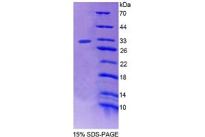 SDS-PAGE analysis of Human PTPN3 Protein. (PTPN3 Protéine)