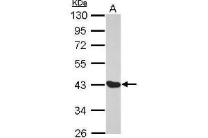 Melanoma Antigen Family D, 4 (MAGED4) (Center) anticorps