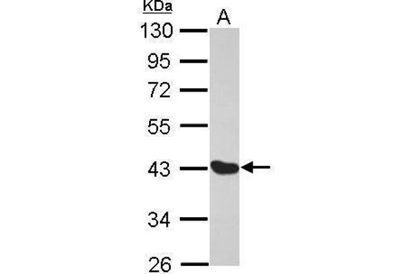 Melanoma Antigen Family D, 4 (MAGED4) (Center) anticorps
