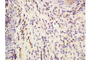Formalin-fixed and paraffin embedded mouse intestine labeled with Anti-IL-3 Polyclonal Antibody, Unconjugated  at 1:200 followed by conjugation to the secondary antibody and DAB staining. (IL-3 anticorps  (AA 101-166))