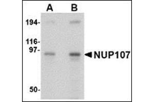 Western blot analysis of NUP107 in A549 cell lysate with this product at (A) 1 and (B) 2 μg/ml.