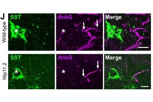 Representative micrographs showing immunohistochemical labelling for SSt (green), the AIS marker AnkyrinG (AnkG, magenta, cat. (Ankyrin G anticorps)