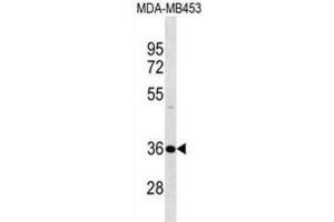 Western Blotting (WB) image for anti-DnaJ (Hsp40) Homolog, Subfamily B, Member 2 (DNAJB2) antibody (ABIN3000576) (DNAJB2 anticorps)