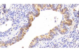 Detection of CK13 in Human Lung Tissue using Polyclonal Antibody to Cytokeratin 13 (CK13) (Cytokeratin 13 anticorps  (AA 104-403))