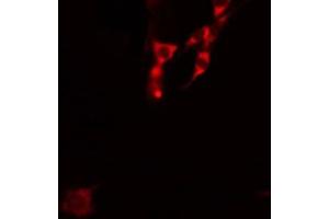 anti-Interleukin 4 Receptor (IL4R) (N-Term) antibody