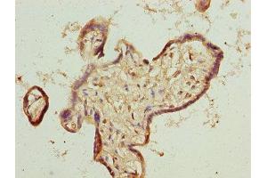 Immunohistochemistry of paraffin-embedded human placenta tissue using ABIN7173261 at dilution of 1:100 (TMEM65 anticorps  (AA 63-240))