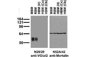 Immunoblot versus crude brain membranes from adult mouse (MBM), rat (RBM) and human hippocampus [HBM(H)], cerebral cortex [HBM(Cx)] and cerebellum [HBM(Cb)] probed with N29/29 (left) and N52A/42 (right) TC supe.