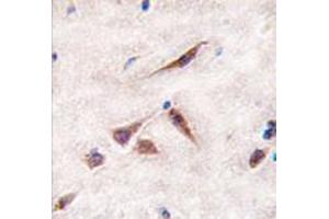 Image no. 1 for anti-ES cell expressed Ras (ERAS) (N-Term) antibody (ABIN356980)