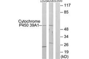 Western blot analysis of extracts from LOVO/HuvEc cells, using Cytochrome P450 39A1 Antibody. (CYP39A1 anticorps  (AA 361-410))