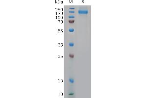 Cynomolgus NCL Protein, His Tag on SDS-PAGE under reducing condition.