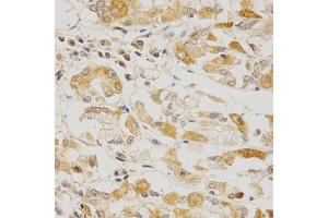 Immunohistochemistry of paraffin-embedded human stomach using OLR1 Antibody (ABIN5970808) at dilution of 1/200 (40x lens). (OLR1 anticorps)