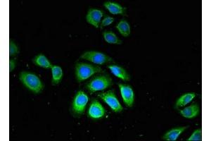 Immunofluorescent analysis of A549 cells using ABIN7163349 at dilution of 1:100 and Alexa Fluor 488-congugated AffiniPure Goat Anti-Rabbit IgG(H+L)