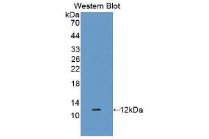 Western blot analysis of the recombinant protein. (beta Defensin 1 anticorps  (AA 22-69))