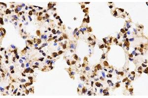 Immunohistochemistry of paraffin-embedded Rat lung using Asymmetric DiMethyl-Histone H3-R17 Polyclonal Antibody at dilution of 1:200 (40x lens).