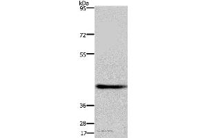 Western blot analysis of Human fetal brain tissue, using DRG1 Polyclonal Antibody at dilution of 1:500 (DRG1 anticorps)