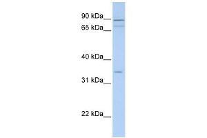 Tenomodulin antibody used at 1 ug/ml to detect target protein. (TNMD anticorps  (Middle Region))