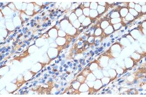 Immunohistochemistry of paraffin-embedded Human colon using HHLA2 Polyclonal Antibody at dilution of 1:100 (40x lens).