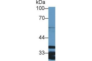 Detection of ARPC2 in Human Lung lysate using Polyclonal Antibody to Actin Related Protein 2/3 Complex Subunit 2 (ARPC2)