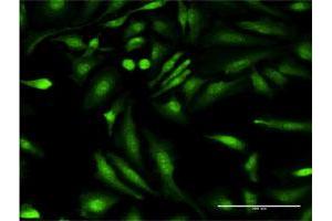 Immunofluorescence of monoclonal antibody to HGD on HeLa cell. (HGD anticorps  (AA 377-445))
