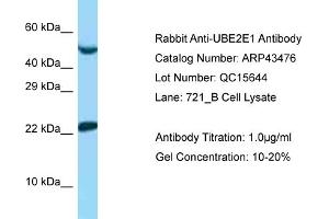 Western Blotting (WB) image for anti-Ubiquitin-Conjugating Enzyme E2E 1 (UBE2E1) (N-Term) antibody (ABIN2781284) (UBE2E1 anticorps  (N-Term))