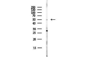 Western blot analysis of lysates from EC304 cells(LPS,4h treatment), using WASH1 Antibody at 1/1000 dilution. (WAS Protein Family Homolog 1 (WASH1) anticorps)