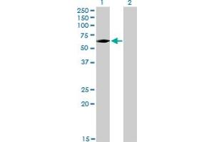 Western Blot analysis of IRAK3 expression in transfected 293T cell line by IRAK3 monoclonal antibody (M02), clone 1F6. (IRAK3 anticorps  (AA 497-596))