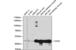 Western blot analysis of extracts of various cell lines, using CDSN antibody (ABIN7266503) at 1:1000 dilution. (Corneodesmosin anticorps  (AA 100-200))