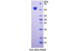 SDS-PAGE analysis of Mouse DAG1 Protein. (Dystroglycan Protéine)