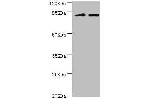 Western blot All lanes: KIF2B antibody at 3. (KIF2B anticorps  (AA 544-673))