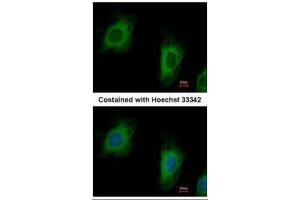 ICC/IF Image Immunofluorescence analysis of paraformaldehyde-fixed HeLa, using TTC1, antibody at 1:500 dilution. (TTC1 anticorps)