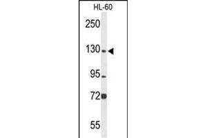 Western blot analysis of MCM2 Antibody (C-term) (ABIN653324 and ABIN2842815) in HL-60 cell line lysates (35 μg/lane). (MCM2 anticorps  (C-Term))