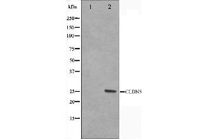 Western blot analysis on A549 cell lysate using Claudin 5 Antibody,The lane on the left is treated with the antigen-specific peptide. (Claudin 5 anticorps  (C-Term))