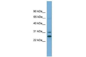 Western Blot showing DHRS2 antibody used at a concentration of 1-2 ug/ml to detect its target protein. (DHRS2 anticorps  (N-Term))