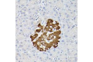 Immunohistochemistry of paraffin-embedded rat pancreatic islet using Insulin Rabbit pAb (ABIN3022884, ABIN3022885, ABIN3022886 and ABIN6219279) at dilution of 1:100 (40x lens). (Insulin anticorps  (AA 1-110))
