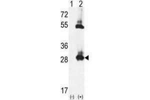 Western blot analysis of TPK1 (arrow) using rabbit polyclonal TPK1 Antibody (N-term) .