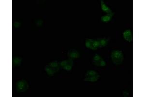 Immunofluorescence staining of HepG2 cells with ABIN7139715 at 1:50, counter-stained with DAPI. (alpha 1 Adrenergic Receptor anticorps  (AA 6-22))