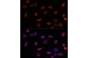 Immunofluorescence analysis of U-2OS using SF3B1 antibody (ABIN7270543) at dilution of d100 (40x lens).