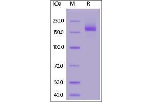 SARS-CoV-2 S protein, His Tag, Super stable trimer on  under reducing (R) condition.
