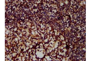 IHC image of ABIN6999591 diluted at 1:300 and staining in paraffin-embedded human tonsil tissue performed on a Leica BondTM system. (MX2 anticorps  (AA 548-688))
