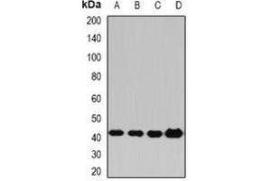 Western blot analysis of PP2C-alpha expression in Hela (A), HepG2 (B), mouse liver (C), rat brain (D) whole cell lysates. (PPM1A anticorps)