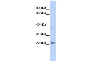 WB Suggested Anti-SRY Antibody Titration:  0. (SRY anticorps  (Middle Region))