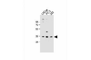 All lanes : Anti-OR6C3 Antibody (Center) at 1:1000 dilution Lane 1: LNCap whole cell lysate Lane 2: PC-3 whole cell lysate Lane 3: 293 whole cell lysate Lysates/proteins at 20 μg per lane. (OR6C3 anticorps  (AA 203-238))
