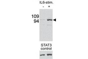 Western blot testing of p-STAT3 antibody and mouse liver tissue/lysate collected before (-) or after (+) stimulation with IL-6 injection in mouse portal vein.