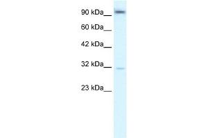 WB Suggested Anti-AHR Antibody Titration:  2. (Aryl Hydrocarbon Receptor anticorps  (N-Term))