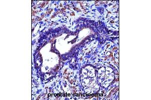 anti-Actin, gamma 2, Smooth Muscle, Enteric (ACTG2) (AA 343-371), (C-Term) antibody