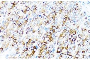 Immunohistochemistry of paraffin-embedded Mouse stomach using SERPINA7 Polyclonal Antibody at dilution of 1:100 (40x lens). (SERPINA7 anticorps)