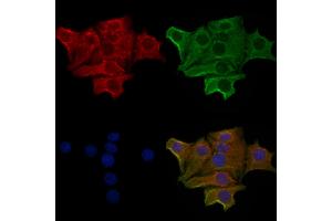 ABIN6259421 and ABIN6276196 staining Hela cells by IF/ICC.